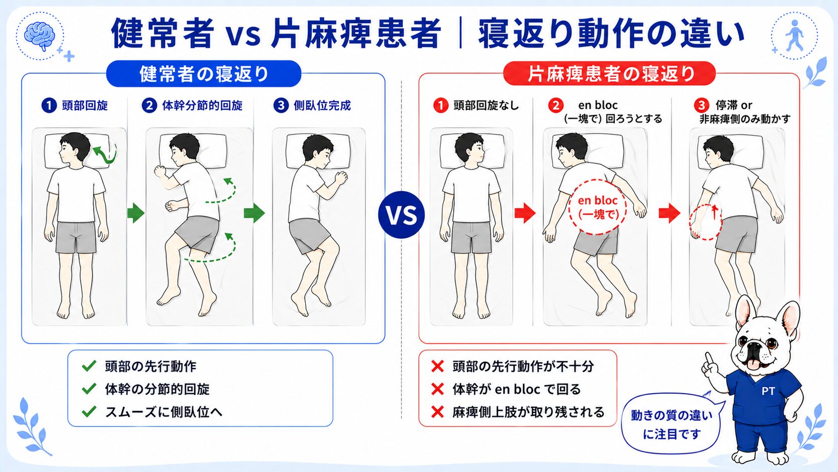 健常者と片麻痺患者の寝返り動作の比較図