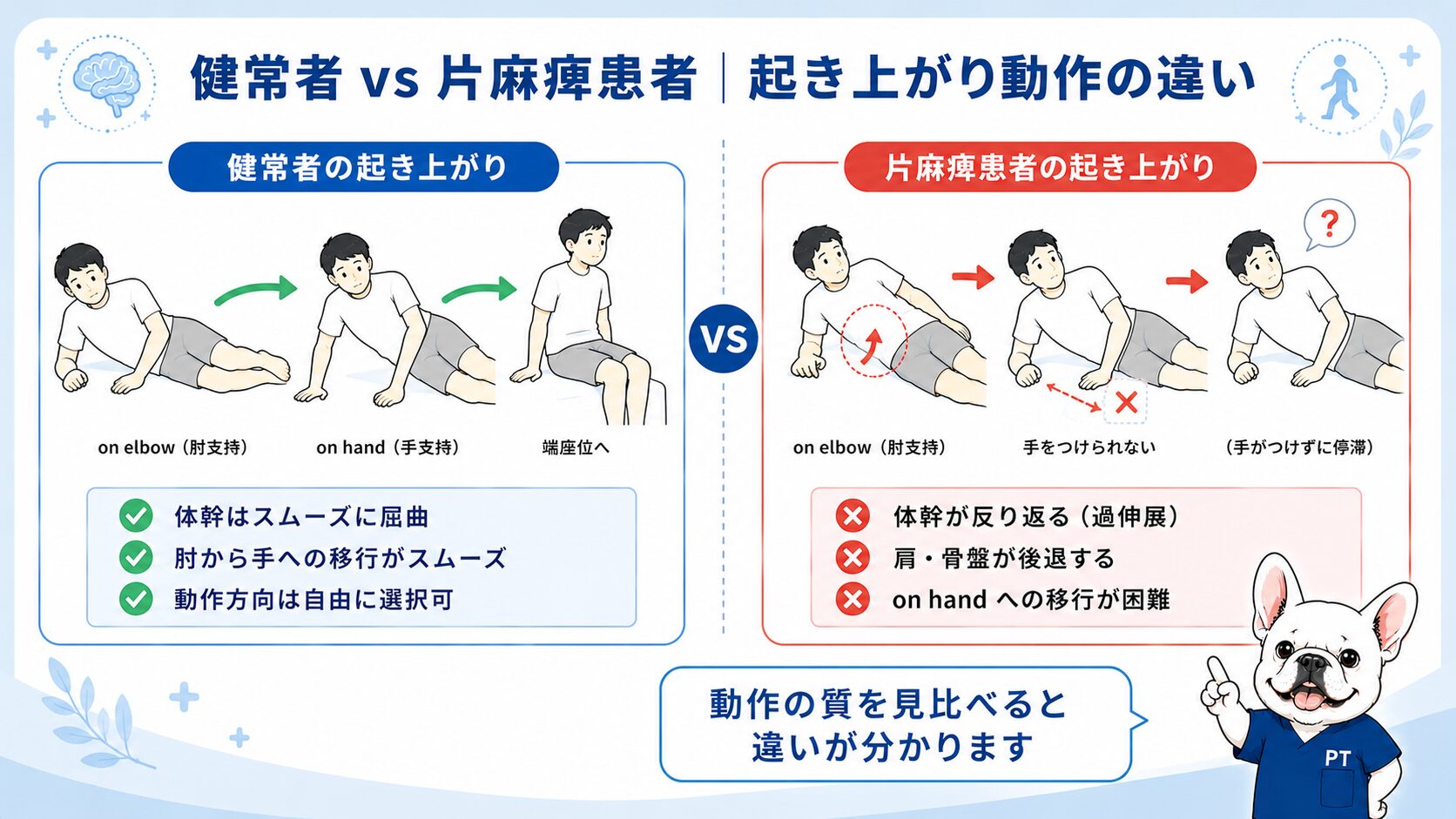 健常者と片麻痺患者の起き上がり動作の比較図