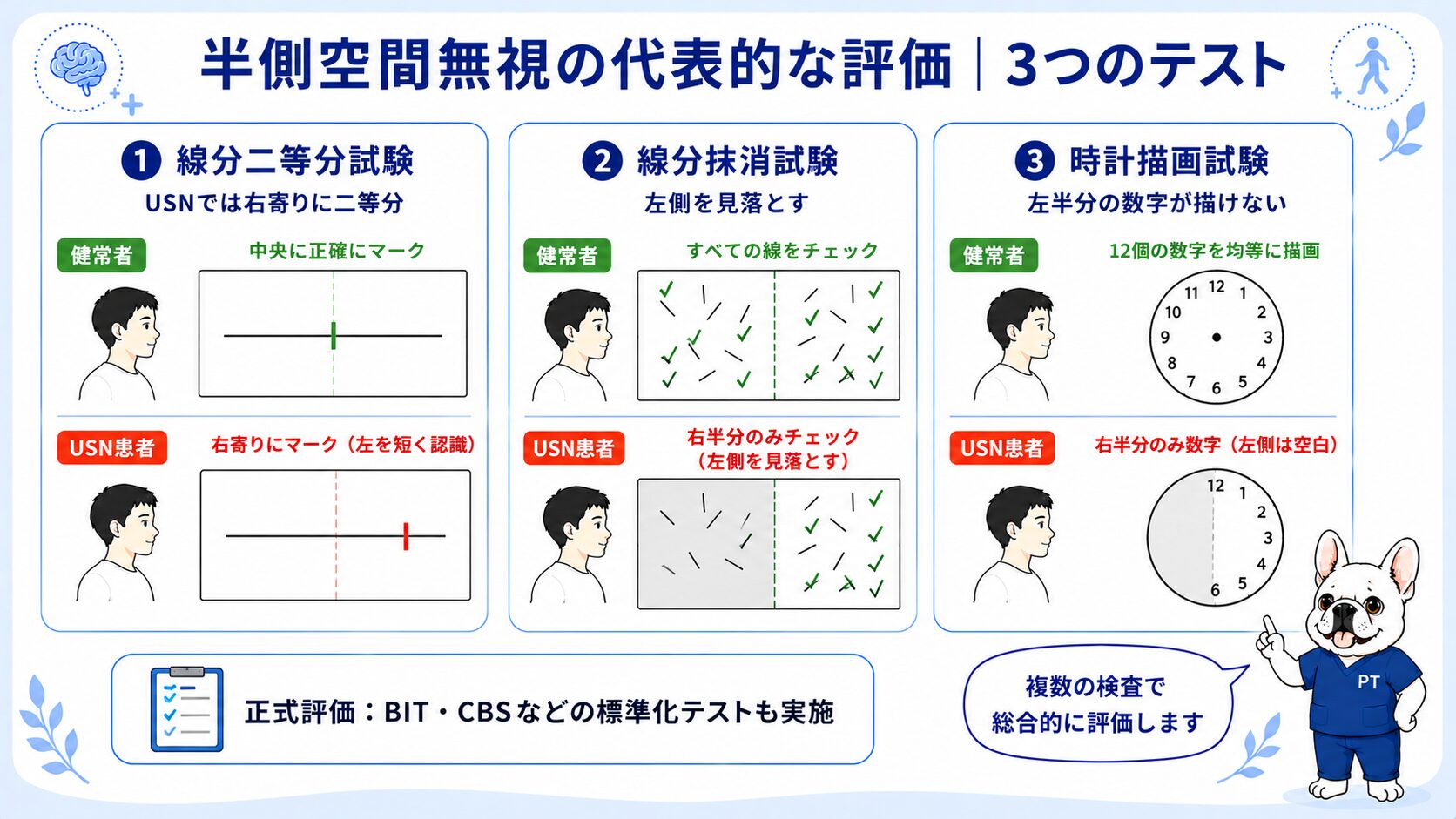 半側空間無視の代表的な3つの評価(線分二等分試験・線分抹消試験・時計描画試験)